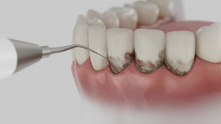 Trusted Root Canal Treatment service in Prudhoe Bay, AK - Dentist Open Now